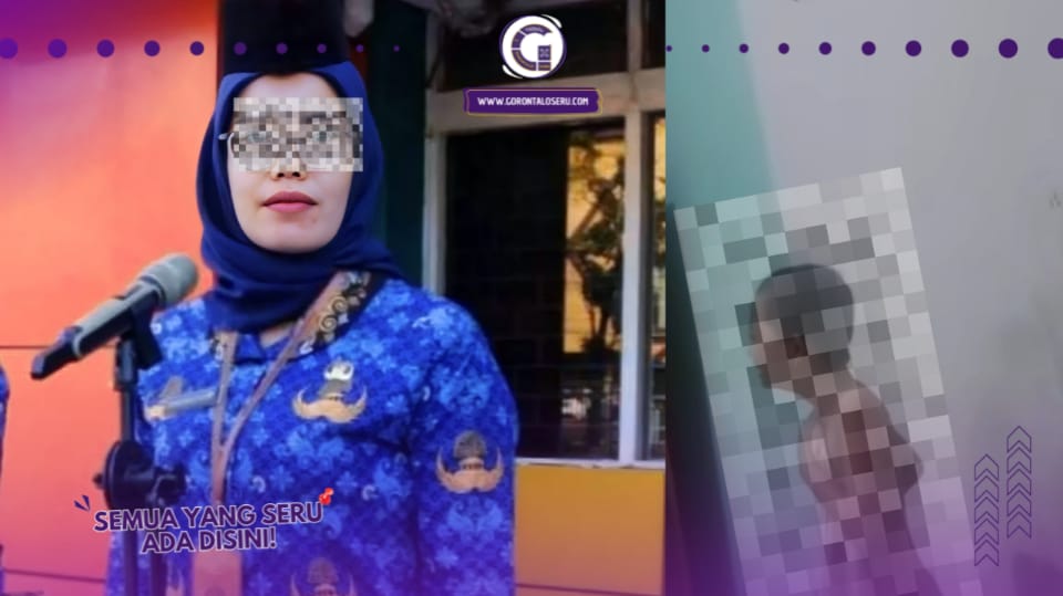 Biadab! Ibu Tiri Tega Aniaya Anak Sambungnya: Siram Tubuh Mungil Dengan Air Mendidih