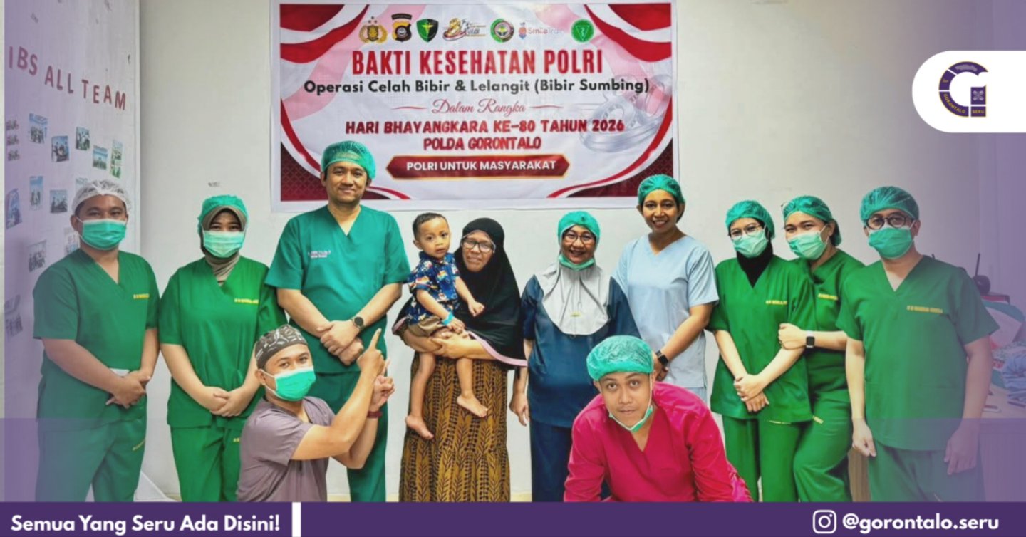 Sambut Hari Bhayangkara, Polda Gorontalo Gelar Operasi Bibir Sumbing Gratis untuk 20 Anak